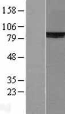 Western Blot: Ku80 Overexpression Lysate (Adult Normal) [NBL1-17918] Left-Empty vector transfected control cell lysate (HEK293 cell lysate); Right -Over-expression Lysate for Ku80.