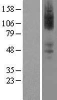 Western Blot: Alpha 2a Adrenergic Receptor Overexpression Lysate (Adult Normal) [NBL1-07357] Left-Empty vector transfected control cell lysate (HEK293 cell lysate); Right -Over-expression Lysate for Alpha 2a Adrenergic Receptor.