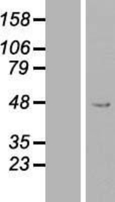 Western Blot: PEX13 Overexpression Lysate (Adult Normal) [NBL1-14297] Left-Empty vector transfected control cell lysate (HEK293 cell lysate); Right -Over-expression Lysate for PEX13.