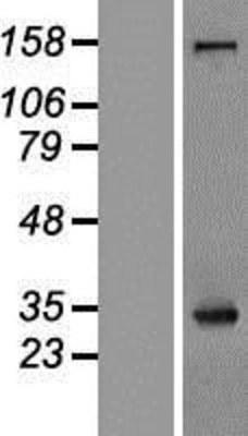 Western Blot: Nucleophosmin Overexpression Lysate (Adult Normal) [NBL1-13750] Left-Empty vector transfected control cell lysate (HEK293 cell lysate); Right -Over-expression Lysate for Nucleophosmin.