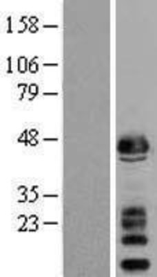 Western Blot: alpha Sarcoglycan Overexpression Lysate (Adult Normal) [NBL1-15902] Left-Empty vector transfected control cell lysate (HEK293 cell lysate); Right -Over-expression Lysate for alpha Sarcoglycan.