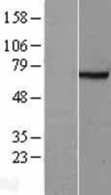 Western Blot: FANCG Overexpression Lysate (Adult Normal) [NBL1-10589] Left-Empty vector transfected control cell lysate (HEK293 cell lysate); Right -Over-expression Lysate for FANCG.