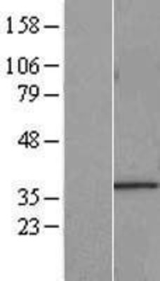 Western Blot: START domain containing 7 Overexpression Lysate (Adult Normal) [NBL1-16521] Left-Empty vector transfected control cell lysate (HEK293 cell lysate); Right -Over-expression Lysate for START domain containing 7.