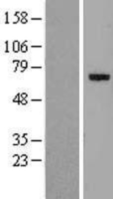 Western Blot: GLIS1 Overexpression Lysate (Adult Normal) [NBL1-11114] Left-Empty vector transfected control cell lysate (HEK293 cell lysate); Right -Over-expression Lysate for GLIS1.