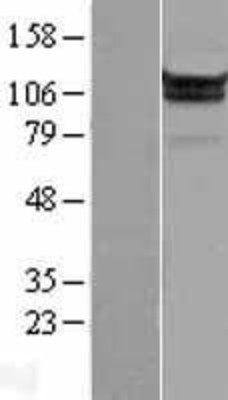 Western Blot: MOV10 Overexpression Lysate (Adult Normal) [NBL1-13194] Left-Empty vector transfected control cell lysate (HEK293 cell lysate); Right -Over-expression Lysate for MOV10.