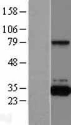 Western Blot: QPRT Overexpression Lysate (Adult Normal) [NBL1-15030] Left-Empty vector transfected control cell lysate (HEK293 cell lysate); Right -Over-expression Lysate for QPRT.
