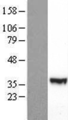 Western Blot: PIK3R3 Overexpression Lysate (Adult Normal) [NBL1-14422] Left-Empty vector transfected control cell lysate (HEK293 cell lysate); Right -Over-expression Lysate for PIK3R3.