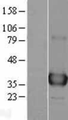 Western Blot: APE1 Overexpression Lysate (Adult Normal) [NBL1-07597] Left-Empty vector transfected control cell lysate (HEK293 cell lysate); Right -Over-expression Lysate for APE1.