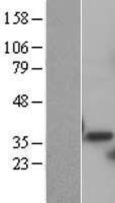 Western Blot: PSMD14 Overexpression Lysate (Adult Normal) [NBL1-14899] Left-Empty vector transfected control cell lysate (HEK293 cell lysate); Right -Over-expression Lysate for PSMD14.