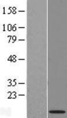 Western Blot: NRARP Overexpression Lysate (Adult Normal) [NBL1-13784] - Western Blot experiments.  Left-Control; Right -Over-expression Lysate for NRARP