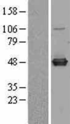 Western Blot: C9orf41 Overexpression Lysate (Adult Normal) [NBL1-08595] Left-Empty vector transfected control cell lysate (HEK293 cell lysate); Right -Over-expression Lysate for C9orf41.