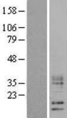 Western Blot: WFDC5 Overexpression Lysate (Adult Normal) [NBL1-17842] Left-Empty vector transfected control cell lysate (HEK293 cell lysate); Right -Over-expression Lysate for WFDC5.