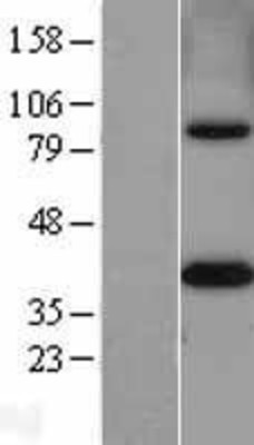Western Blot: MTHFD2 Overexpression Lysate (Adult Normal) [NBL1-13363] Left-Empty vector transfected control cell lysate (HEK293 cell lysate); Right -Over-expression Lysate for MTHFD2.