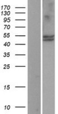Western Blot: CYP11B1 Overexpression Lysate (Adult Normal) [NBP2-04159] Left-Empty vector transfected control cell lysate (HEK293 cell lysate); Right -Over-expression Lysate for CYP11B1.