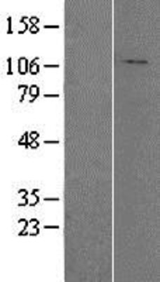 Western Blot: HADHA Overexpression Lysate (Adult Normal) [NBP2-04152] Left-Empty vector transfected control cell lysate (HEK293 cell lysate); Right -Over-expression Lysate for HADHA.