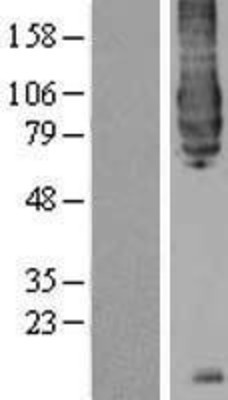 Western Blot: BACE1 Overexpression Lysate (Adult Normal) [NBP2-04325] Left-Empty vector transfected control cell lysate (HEK293 cell lysate); Right -Over-expression Lysate for BACE1.