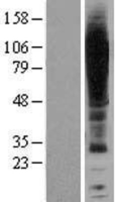 Western Blot: Melatonin Receptor 1B Overexpression Lysate (Adult Normal) [NBP2-04305] Left-Empty vector transfected control cell lysate (HEK293 cell lysate); Right -Over-expression Lysate for Melatonin Receptor 1B.