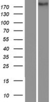 Western Blot: Notch4 Overexpression Lysate (Adult Normal) [NBP2-04274] Left-Empty vector transfected control cell lysate (HEK293 cell lysate); Right -Over-expression Lysate for Notch4.