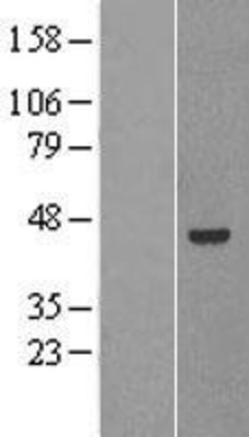 Western Blot: Pancreatic Lipase Related Protein 2 Overexpression Lysate (Adult Normal) [NBP2-04292] Left-Empty vector transfected control cell lysate (HEK293 cell lysate); Right -Over-expression Lysate for Pancreatic Lipase Related Protein 2.