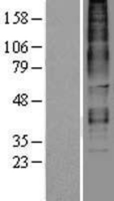 Western Blot: SALPR Overexpression Lysate (Adult Normal) [NBP2-04358] Left-Empty vector transfected control cell lysate (HEK293 cell lysate); Right -Over-expression Lysate for SALPR.