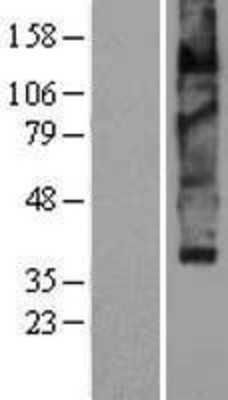 Western Blot: VMAT2 Overexpression Lysate (Adult Normal) [NBP2-04241] Left-Empty vector transfected control cell lysate (HEK293 cell lysate); Right -Over-expression Lysate for VMAT2.