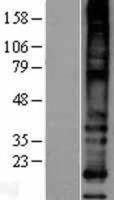 Western Blot: MS4A8B Overexpression Lysate (Adult Normal) [NBP2-04399] Left-Empty vector transfected control cell lysate (HEK293 cell lysate); Right -Over-expression Lysate for MS4A8B.