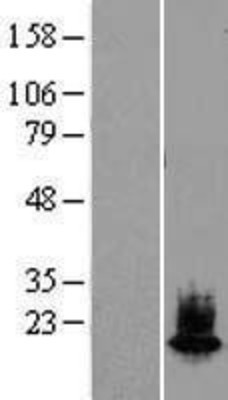 Western Blot: alpha-Synuclein Overexpression Lysate (Adult Normal) [NBL1-16274] Left-Empty vector transfected control cell lysate (HEK293 cell lysate); Right -Over-expression Lysate for alpha-Synuclein.