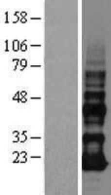 Western Blot: VOPP1 Overexpression Lysate (Adult Normal) [NBL1-10101] Left-Empty vector transfected control cell lysate (HEK293 cell lysate); Right -Over-expression Lysate for VOPP1.