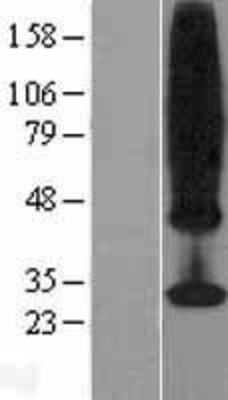 Western Blot: MS4A4A Overexpression Lysate (Adult Normal) [NBL1-13318] Left-Empty vector transfected control cell lysate (HEK293 cell lysate); Right -Over-expression Lysate for MS4A4A.