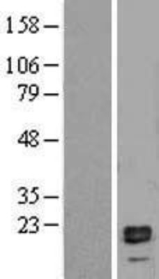 Western Blot: IL1 beta Overexpression Lysate (Adult Normal) [NBP2-04165] Left-Empty vector transfected control cell lysate (HEK293 cell lysate); Right -Over-expression Lysate for IL1 beta.