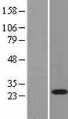 Western Blot: Rab11A Overexpression Lysate (Adult Normal) [NBL1-15038] Left-Empty vector transfected control cell lysate (HEK293 cell lysate); Right -Over-expression Lysate for Rab11A.