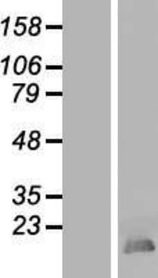 Western Blot: HMGB4 Overexpression Lysate (Adult Normal) [NBL1-11616] Left-Empty vector transfected control cell lysate (HEK293 cell lysate); Right -Over-expression Lysate for HMGB4.