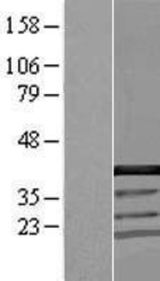 Western Blot: CCDC94 Overexpression Lysate (Adult Normal) [NBL1-08833] Left-Empty vector transfected control cell lysate (HEK293 cell lysate); Right -Over-expression Lysate for CCDC94.