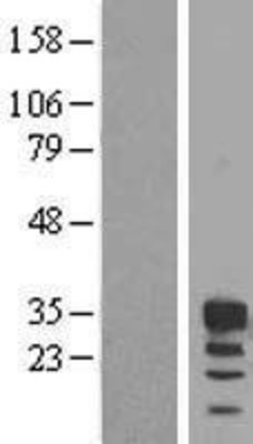 Western Blot: FBXO6 Overexpression Lysate (Adult Normal) [NBL1-10640] Left-Empty vector transfected control cell lysate (HEK293 cell lysate); Right -Over-expression Lysate for FBXO6.
