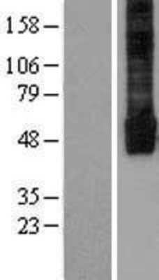Western Blot: KIR2.3 Overexpression Lysate (Adult Normal) [NBL1-12171] Left-Empty vector transfected control cell lysate (HEK293 cell lysate); Right -Over-expression Lysate for KIR2.3.