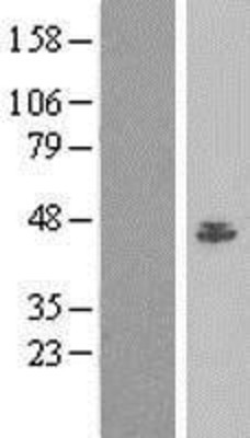 Western Blot: BAF53A Overexpression Lysate (Adult Normal) [NBL1-07276] Left-Empty vector transfected control cell lysate (HEK293 cell lysate); Right -Over-expression Lysate for BAF53A.