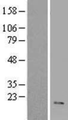 Western Blot: VIP Overexpression Lysate (Adult Normal) [NBL1-17722] Left-Empty vector transfected control cell lysate (HEK293 cell lysate); Right -Over-expression Lysate for VIP.