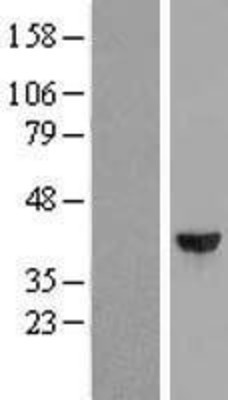 Western Blot: DCPS Overexpression Lysate (Adult Normal) [NBL1-09747] Left-Empty vector transfected control cell lysate (HEK293 cell lysate); Right -Over-expression Lysate for DCPS.