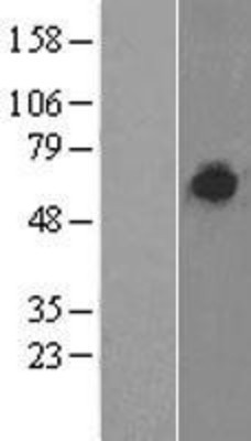 Western Blot: CEACAM6 Overexpression Lysate (Adult Normal) [NBP2-04227] Left-Empty vector transfected control cell lysate (HEK293 cell lysate); Right -Over-expression Lysate for CEACAM6.