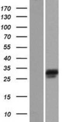 Western Blot: NEBL Overexpression Lysate (Adult Normal) [NBP2-04475] Left-Empty vector transfected control cell lysate (HEK293 cell lysate); Right -Over-expression Lysate for NEBL.