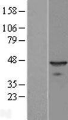 Western Blot: BNIPL Overexpression Lysate (Adult Normal) [NBL1-08016] Left-Empty vector transfected control cell lysate (HEK293 cell lysate); Right -Over-expression Lysate for BNIPL.