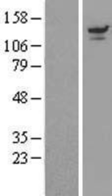Western Blot: UBPY/USP8 Overexpression Lysate (Adult Normal) [NBL1-17672] Left-Empty vector transfected control cell lysate (HEK293 cell lysate); Right -Over-expression Lysate for UBPY/USP8.