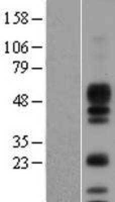 Western Blot: Amphiregulin Overexpression Lysate (Adult Normal) [NBL1-07648] Left-Empty vector transfected control cell lysate (HEK293 cell lysate); Right -Over-expression Lysate for Amphiregulin.