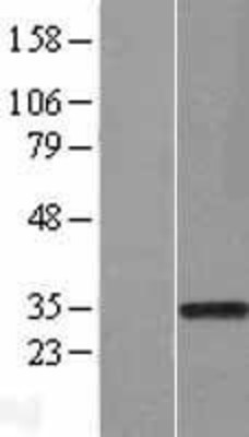 Western Blot: Rad1 Overexpression Lysate (Adult Normal) [NBL1-15110] Left-Empty vector transfected control cell lysate (HEK293 cell lysate); Right -Over-expression Lysate for Rad1.
