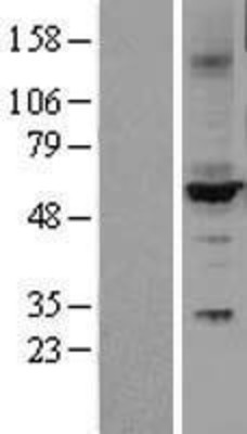 Western Blot: Cytochrome P450 2C9 Overexpression Lysate (Adult Normal) [NBL1-09686] Left-Empty vector transfected control cell lysate (HEK293 cell lysate); Right -Over-expression Lysate for Cytochrome P450 2C9.