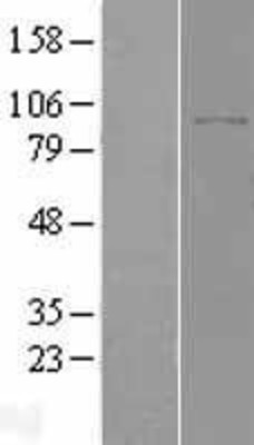 Western Blot: DPP8 Overexpression Lysate (Adult Normal) [NBL1-10000] Left-Empty vector transfected control cell lysate (HEK293 cell lysate); Right -Over-expression Lysate for DPP8.