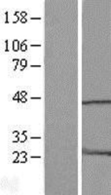 Western Blot: HMG20A Overexpression Lysate (Adult Normal) [NBL1-11606] Left-Empty vector transfected control cell lysate (HEK293 cell lysate); Right -Over-expression Lysate for HMG20A.
