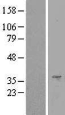 Western Blot: Surf1 Overexpression Lysate (Adult Normal) [NBL1-16620] Left-Empty vector transfected control cell lysate (HEK293 cell lysate); Right -Over-expression Lysate for Surf1.