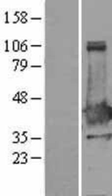 Western Blot: XLF Overexpression Lysate (Adult Normal) [NBL1-13638] Left-Empty vector transfected control cell lysate (HEK293 cell lysate); Right -Over-expression Lysate for XLF.