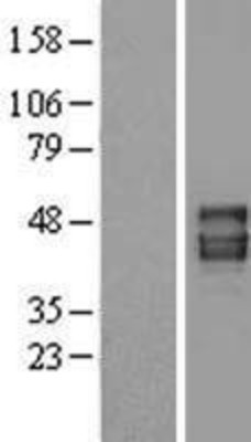 Western Blot: Pannexin 1 Overexpression Lysate (Adult Normal) [NBL1-14093] Left-Empty vector transfected control cell lysate (HEK293 cell lysate); Right -Over-expression Lysate for Pannexin 1.